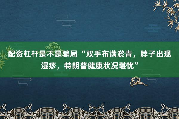 配资杠杆是不是骗局 “双手布满淤青，脖子出现湿疹，特朗普健康状况堪忧”